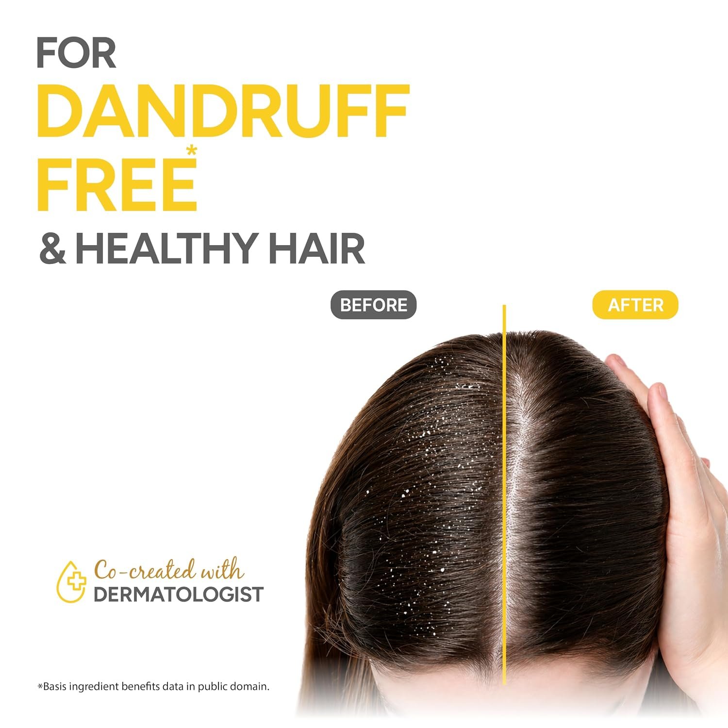 Dabur Vatika Naturals Anti Dandruff Shampoo - 640 ml | 7 Natural Herb Extracts | Contains Lemon, Methi & Tea Tree Oil | Exfoliates Flaky Scalp for Dandruff-Free Hair | thumbnail