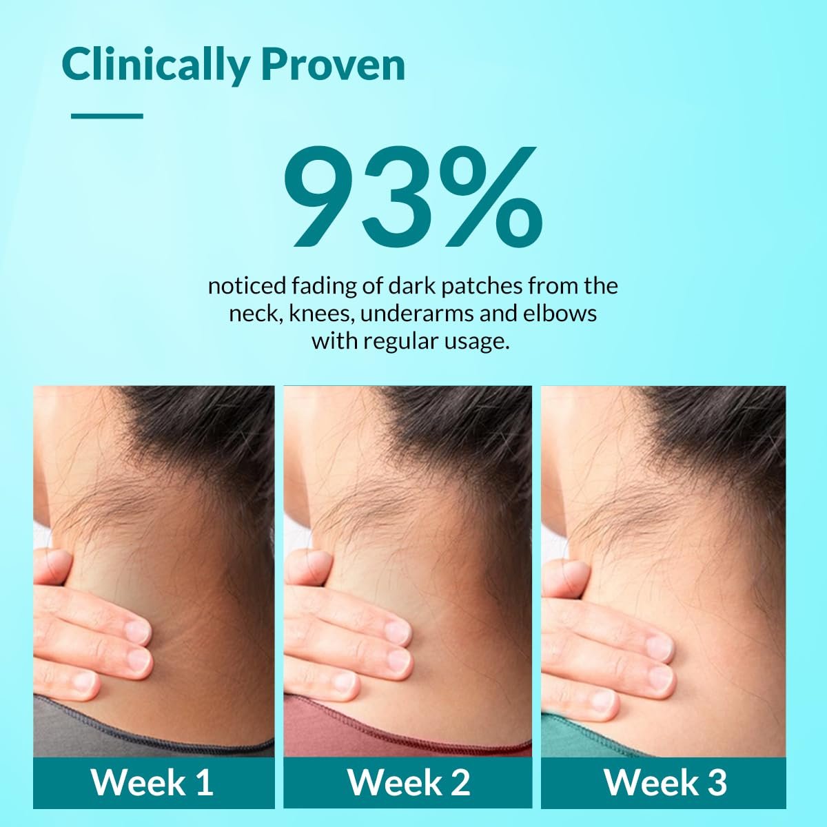Fixderma Nigrifix Cream for Acanthosis Nigricans with Lactic Acid | Dermatologist Tested Retinol Cream | For Dark Body Parts like Neck, Ankles, Thighs & Elbows | Exfoliant- 50g thumbnail