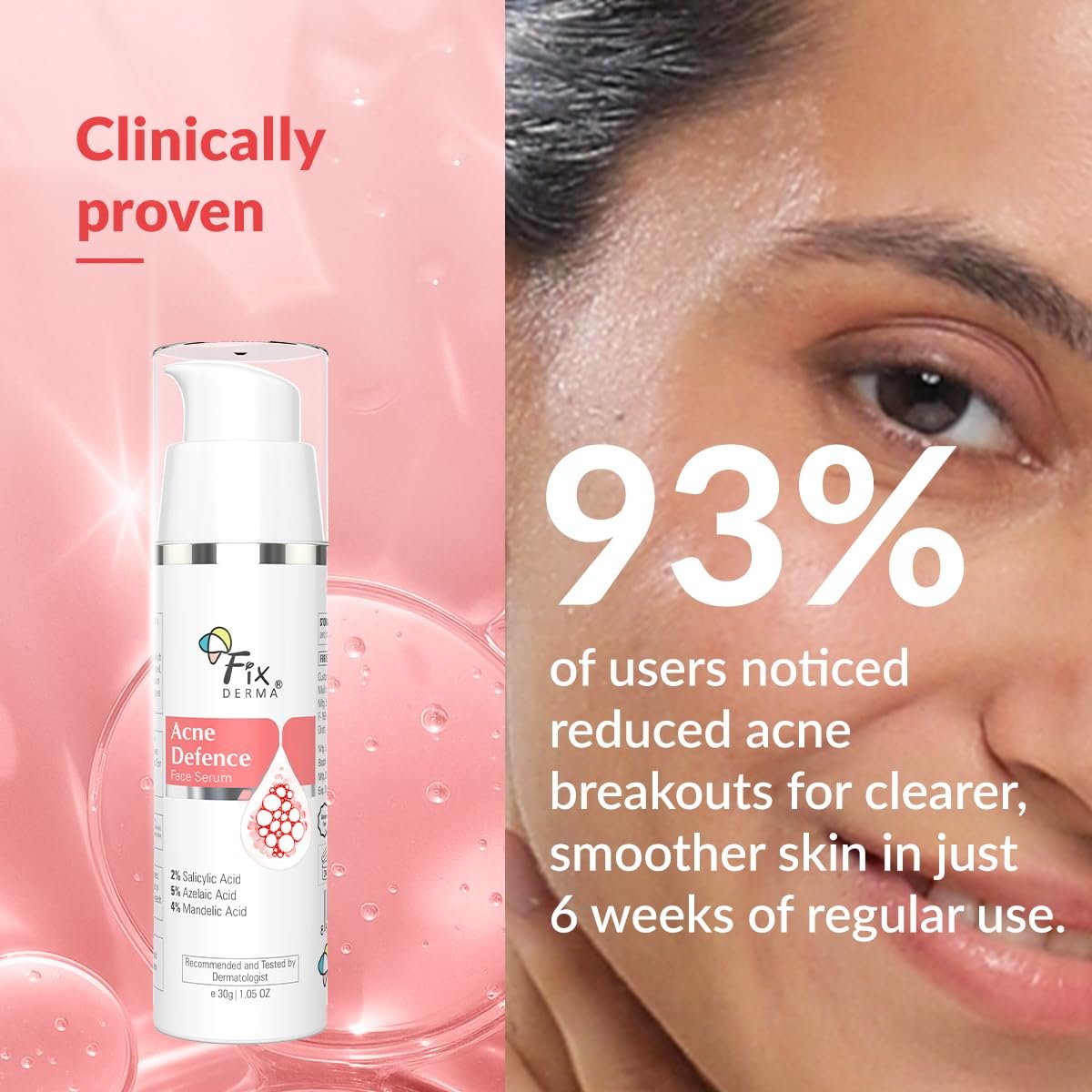 Fixderma 2% Salicylic Acid Serum for Anti Acne & Spot Treatment with 5% Azelaic Acid & 4% Mandelic Acid | Anti Acne Face Serum | Face Serum for Men & Women - 30 gm thumbnail