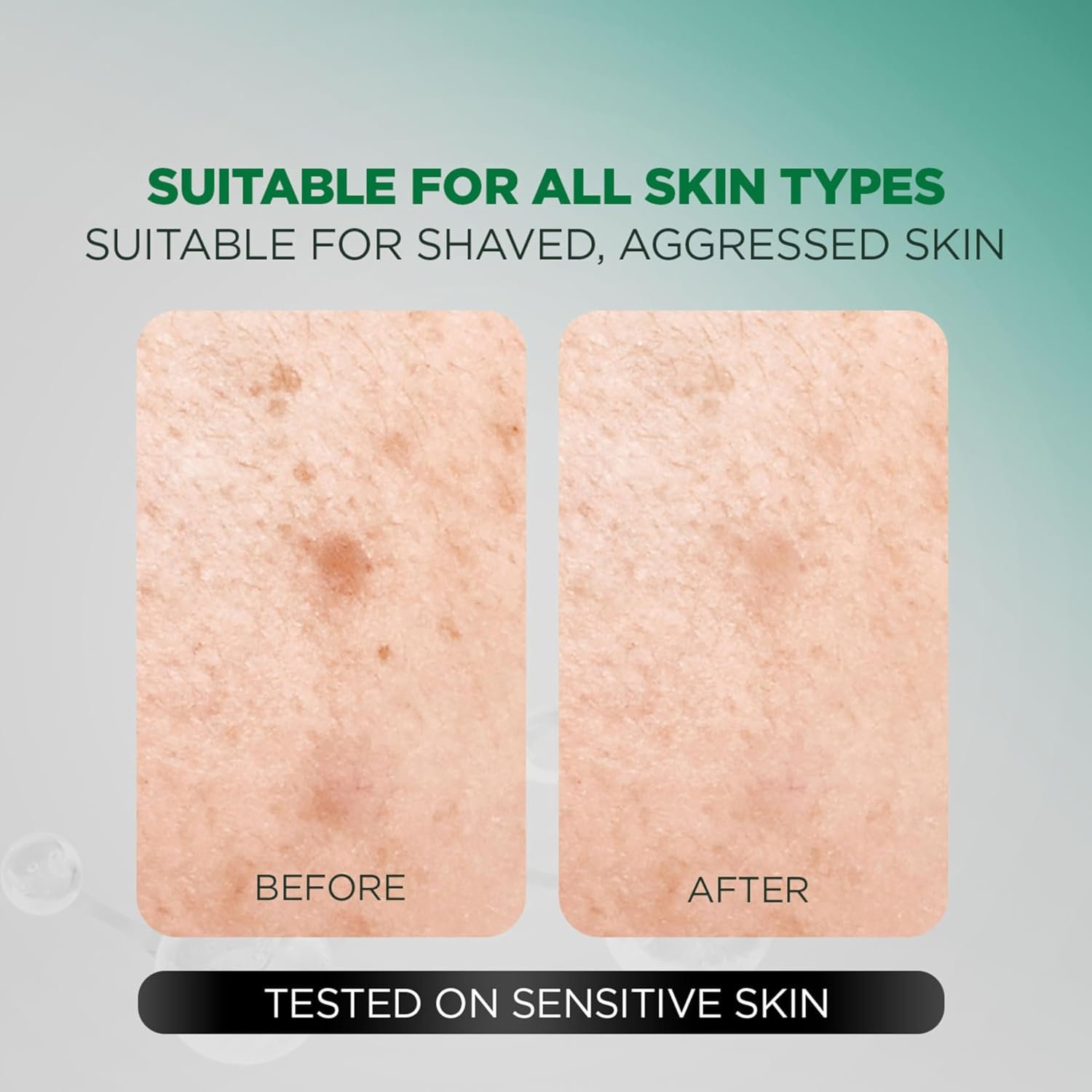 Garnier Men Acno Fight Gentle Cleanser Facewash | For Acne-Prone, Sensitive Male Skin | 100g thumbnail