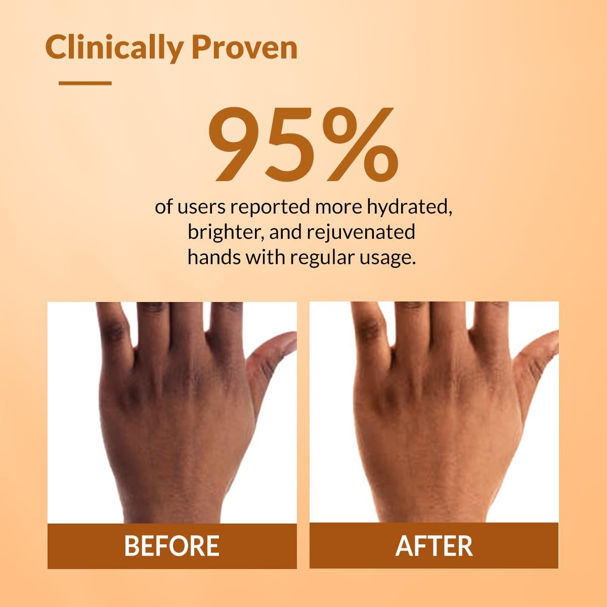 Fixderma Hand Cream for Women & Men | Hand Moisturizer | Hand Cream for Dry and Rough Hands | Cocoa Butter | Cream for Itchy Hand | All Skins Types - 30g thumbnail