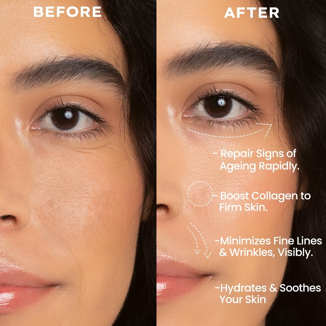 Hyphen 0.1% Retinal Reset Serum Pro | 30% More Effective than Retinol Serum| Advanced Anti Ageing Face Serum | Reduces Fine Lines & Wrinkles | -30 ml thumbnail