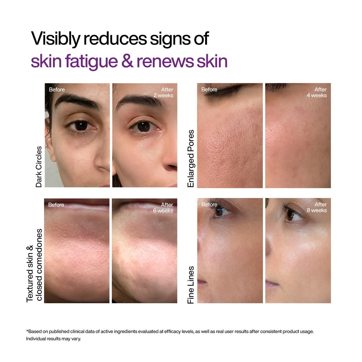 WishCare Cellular Reset 0.1% Retinal Shot- Targets Fine Lines, Wrinkles & Dark Circles | Retinol Shot Booster- 10 ml thumbnail