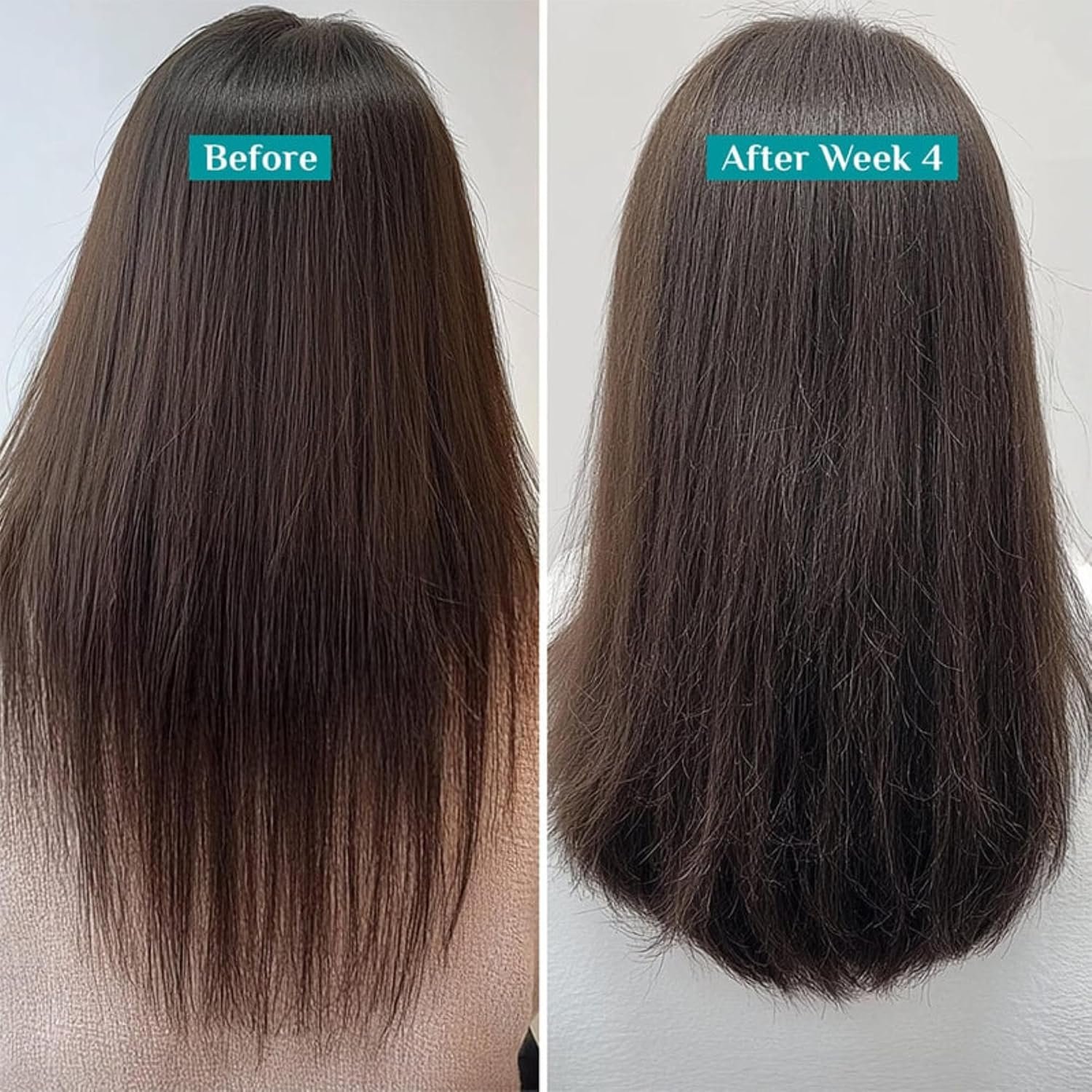 Pilgrim Redensyl & Anagain Hairfall Control Shampoo with Korean Black Rice 200ml | Anti Hairfall shampoo for Men & Women | Reduces Hairfall | Promotes Hair Thickness | For All Hair Types thumbnail