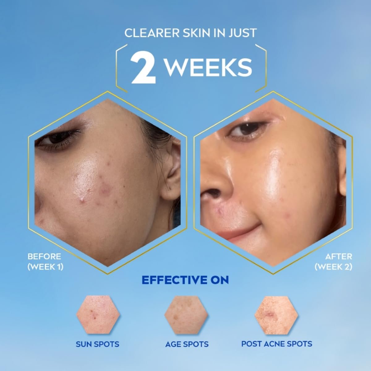 NIVEA Luminous Even Glow Anti-Spot Day Cream 40ml thumbnail