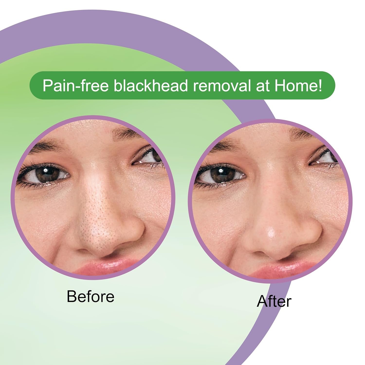 DR.RASHEL Tea Tree Nose Strips | With Tea Tree Oil | Deep Cleansing | Blackhead Removal | Oil Control | 10 Strips + 10 Wipes thumbnail