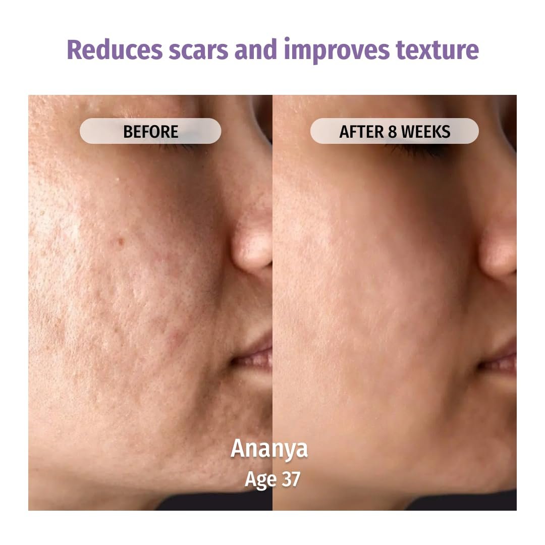 Vilvah Better Ageing Face Serum | Helps Reduce Fine Lines & Wrinkles | Firms, Hydrates & Strengthens Skin Barrier | Beginner-Friendly | 20ml thumbnail