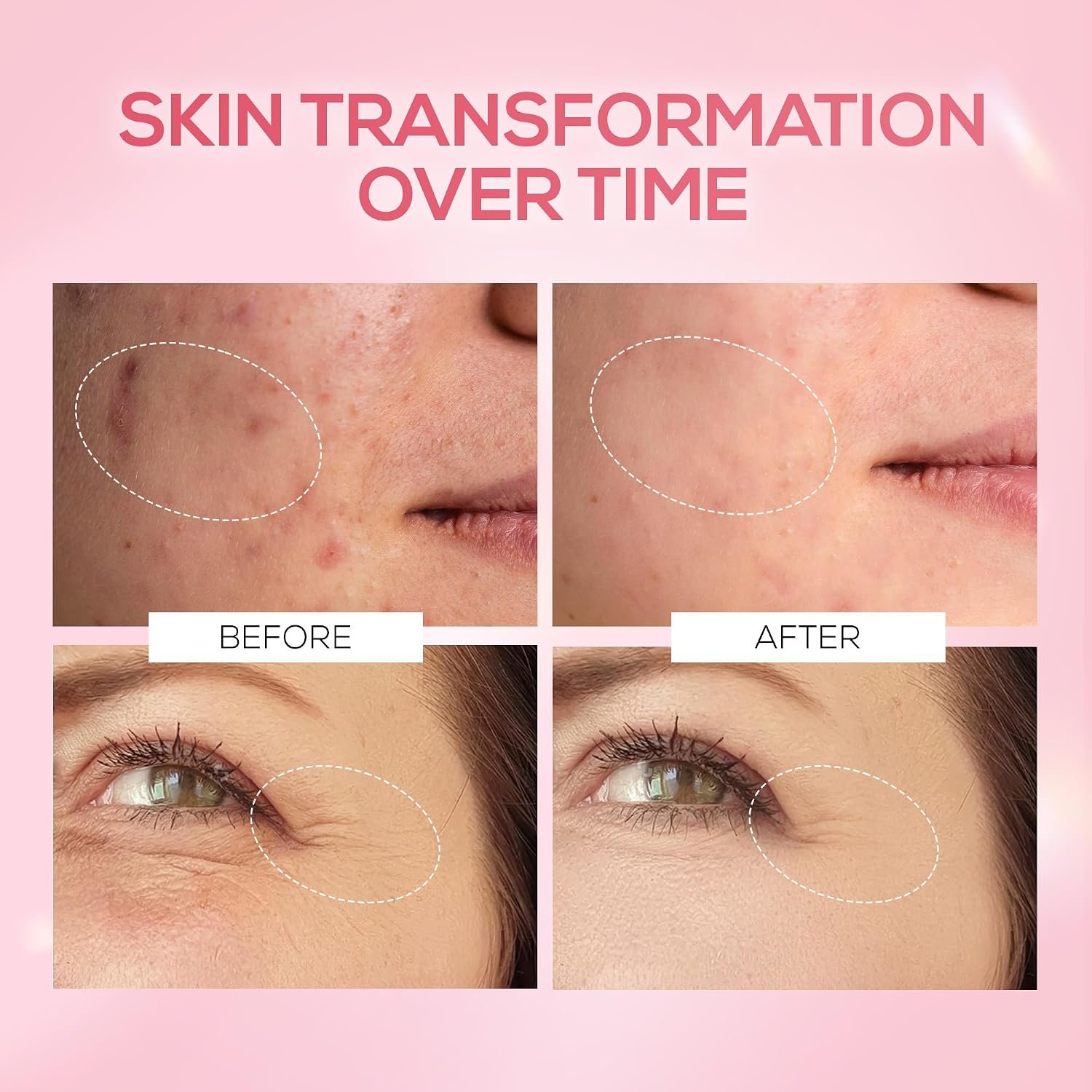 RENEE Pink Therapy PDRN Pink Peptide Face Serum For Glowing, Radiant Skin | Hydrates, Boosts Collagen, Evens Skin Tone | Lightweight, Quick Absorbing | 30ml thumbnail