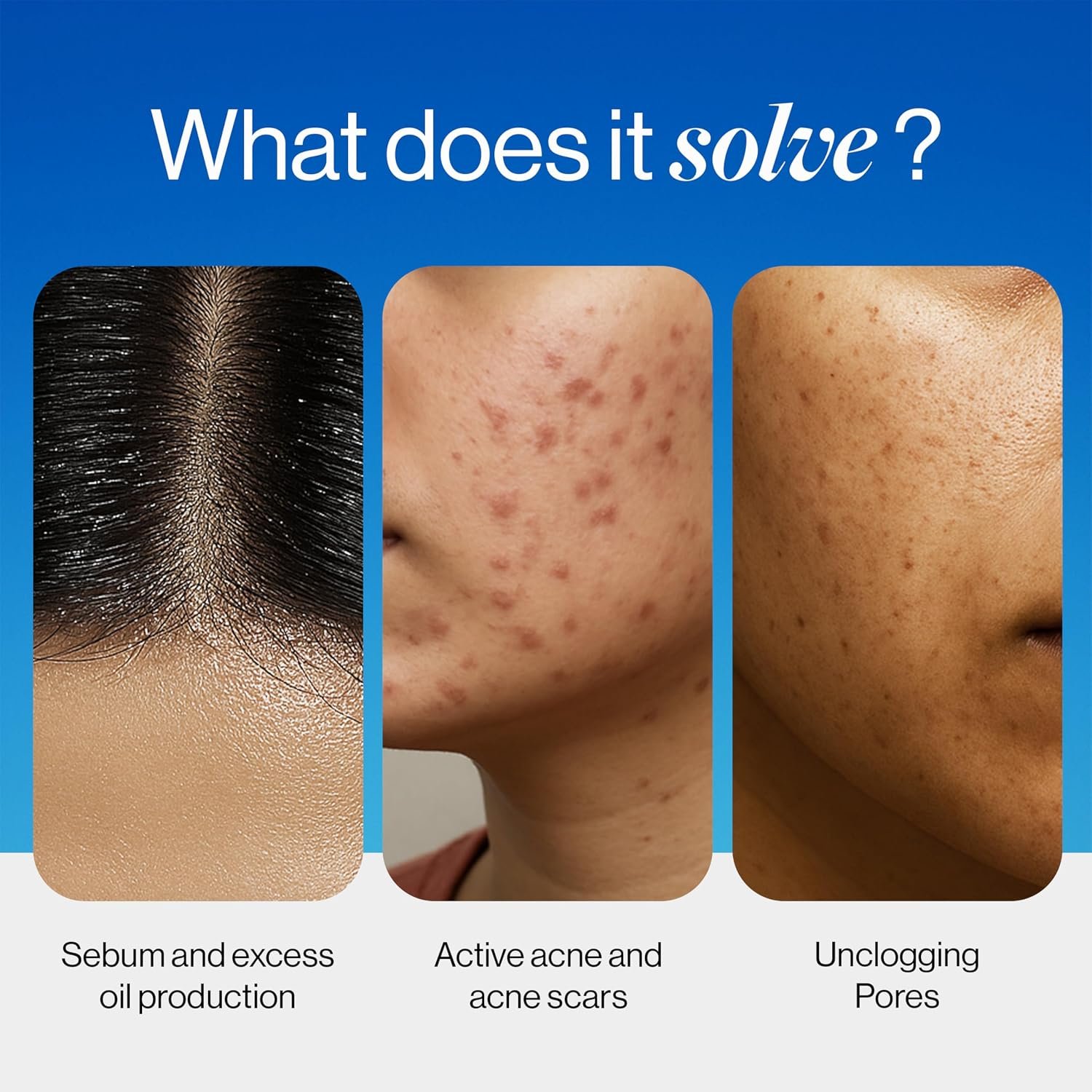 Be Bodywise 2% Salicylic Acid Face Wash for Acne Prone skin | For Oily & Sensitive skin | Deep Cleanses your Skin & Prevents Acne | Developed by Dermatologists | 100ml thumbnail
