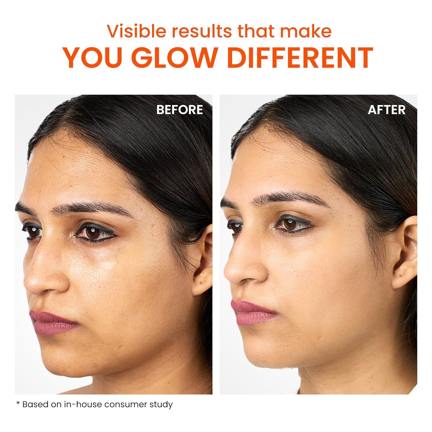 Foxtale Gel Sunscreen for Oily Skin, SPF 50 PA++++, In-Vivo Tested, 50ml No White Cast, Matte Finish, Lightweight, Non Comedogenic, Cica, Niacinamide, Men, Women, Prevent Tan, Water-Based Te thumbnail