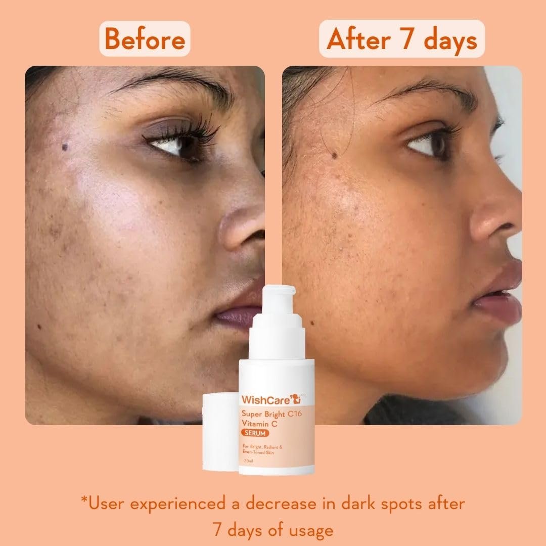 WishCare Super Bright C16 10% Vitamin C Serum For Glowing Skin | With 10% Vitamin C, Niacinamide & Kojic Acid |   For Oily Skin, Dry & Combination Skin | 30ml thumbnail