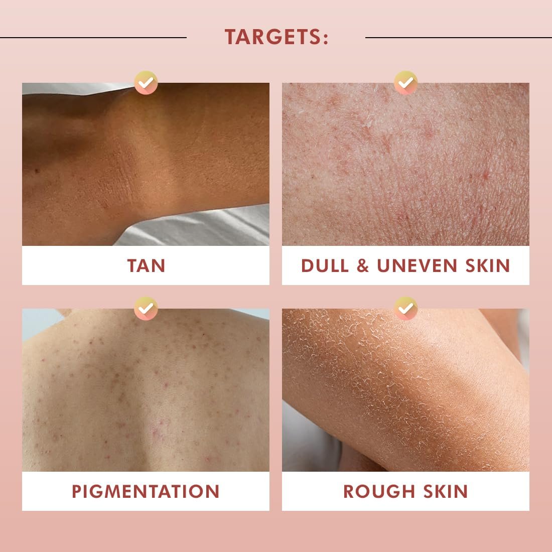 mCaffeine 1% Glycolic Acid Detan Body Wash 300ml | 2% Niacinamide, 3% Kojic Acid-Glutathione | Brightens, Hydrates, Reduces Dark Spots & Evens Tone |  Guava Shower Gel for Dry Skin thumbnail