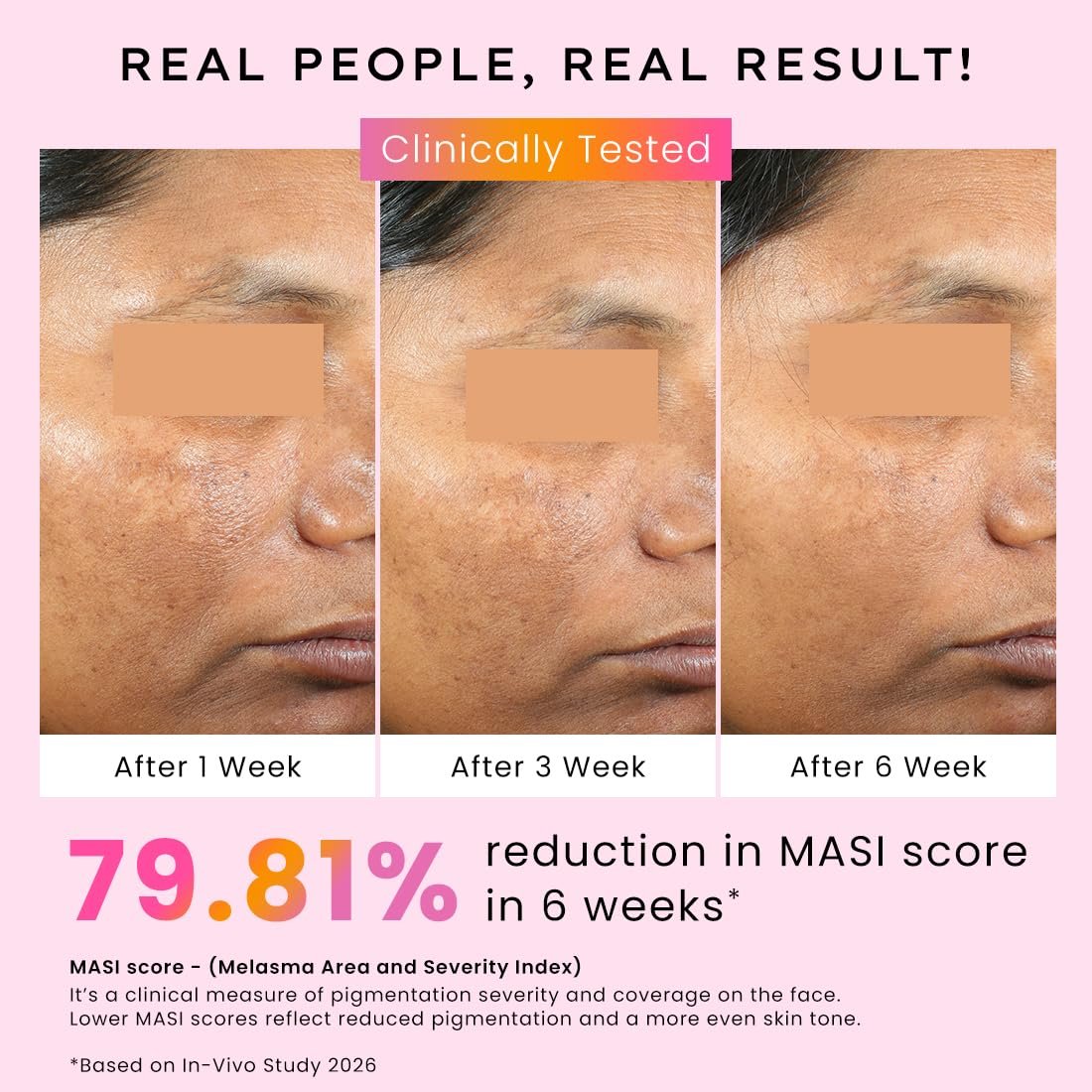 Hyphen 4% Tranexamic Acid + 5% Niacinamide Biphasic De-Pigmentation Serum | Correction & Prevents Hyperpigmentation, Dark Spots & Melasma| Deep Penetration - 30 ml thumbnail