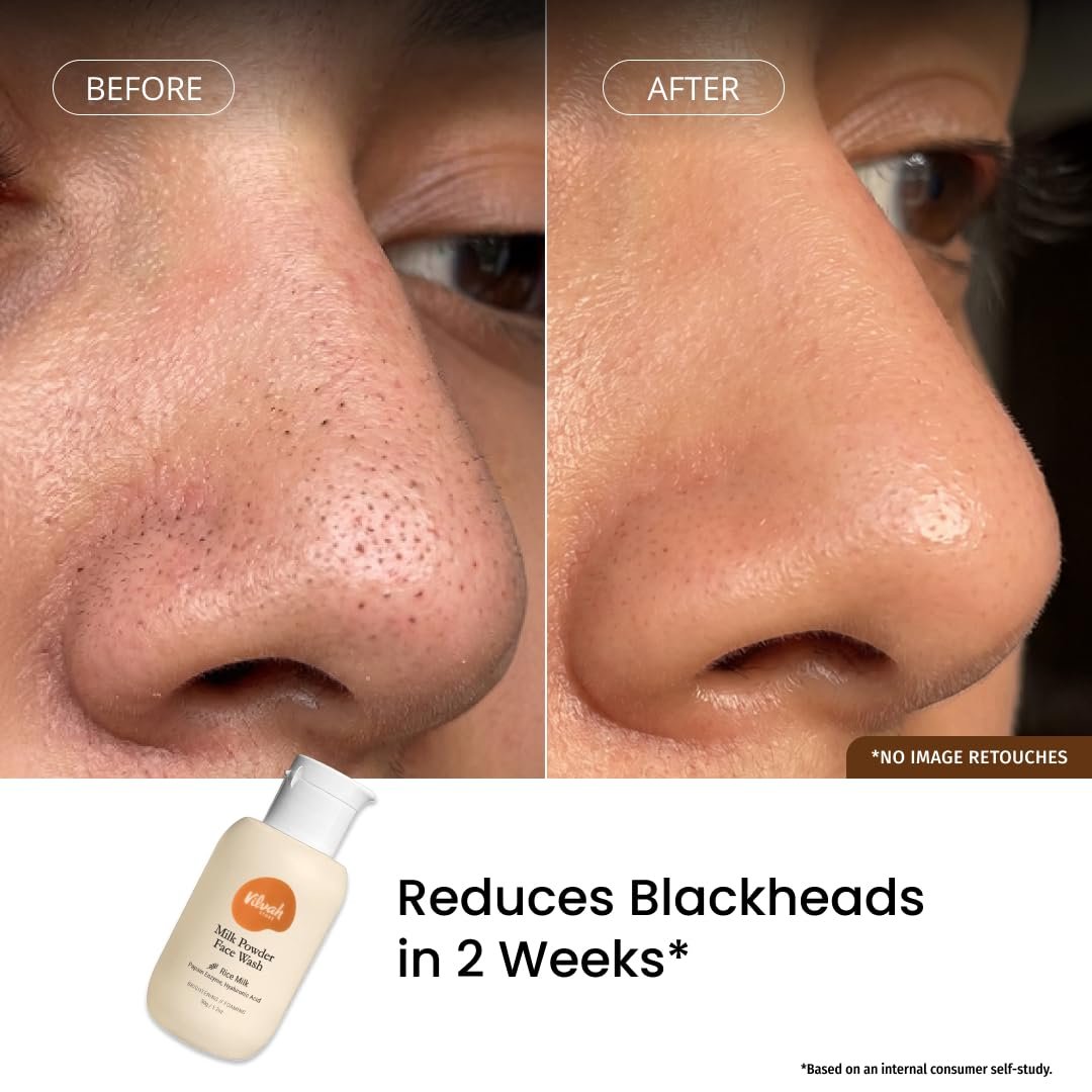c Gentle Exfoliation | Brightens, Hydrates & Evens Skin Tone | Strengthens Barrier & Balances Skin pH | thumbnail