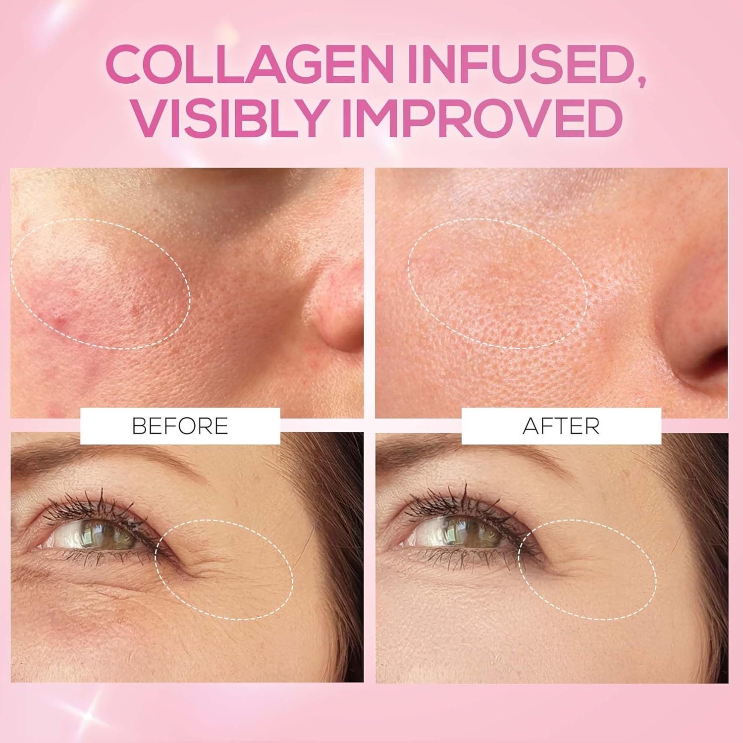 RENEE Pink Therapy Hydrolyzed Collagen Overnight Sleep Jelly Mask | Hydrates, Repairs, Smoothens & Plumps Skin | Peptides, Niacinamide & Hydrolyzed Collagen Enriched | 50 gm thumbnail