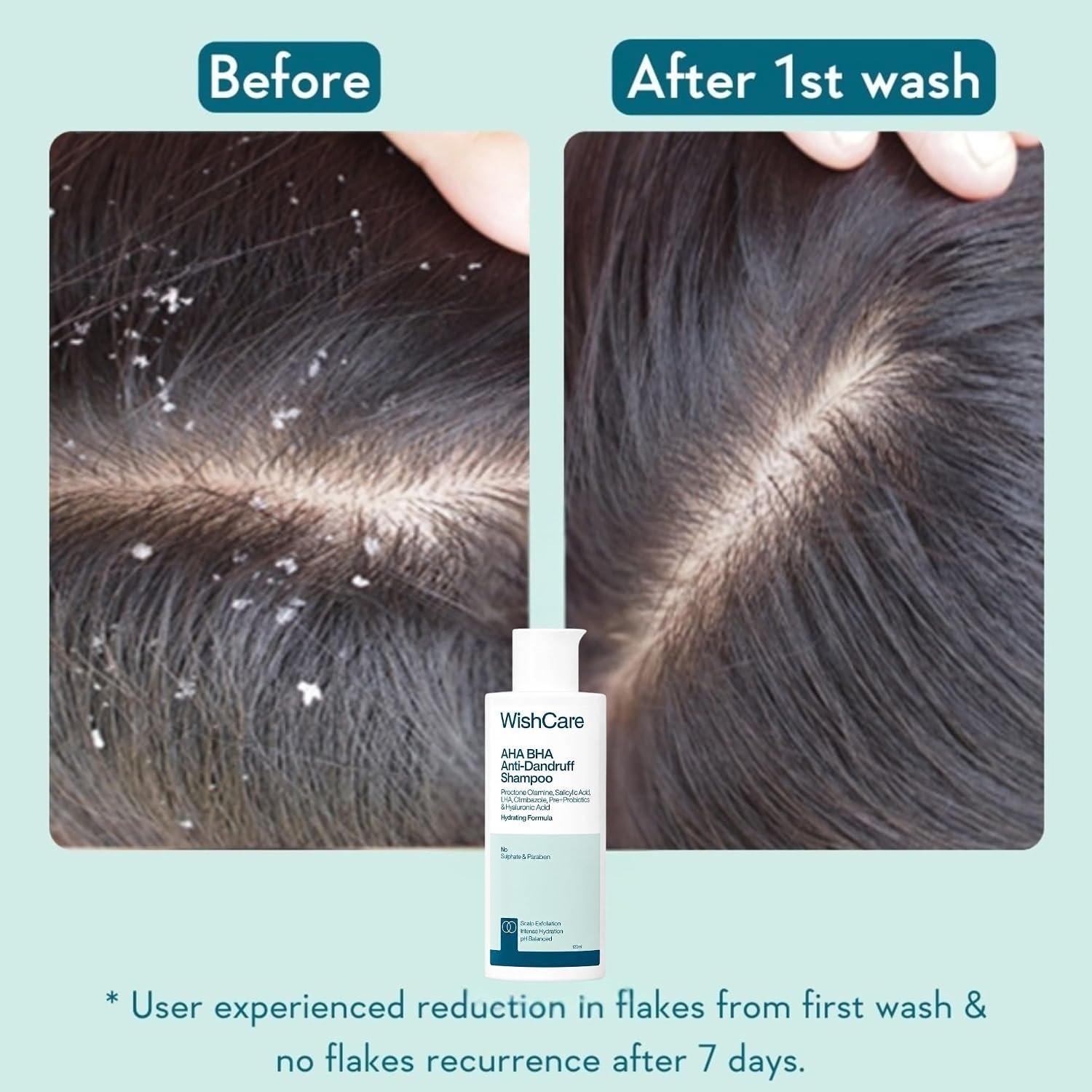 WishCare Hydrating Anti Dandruff Shampoo | 100% Dandruff Reduction | Removes Flakes & Hydrates Scalp | Proven Clinically | For Women And Men | 120ml thumbnail