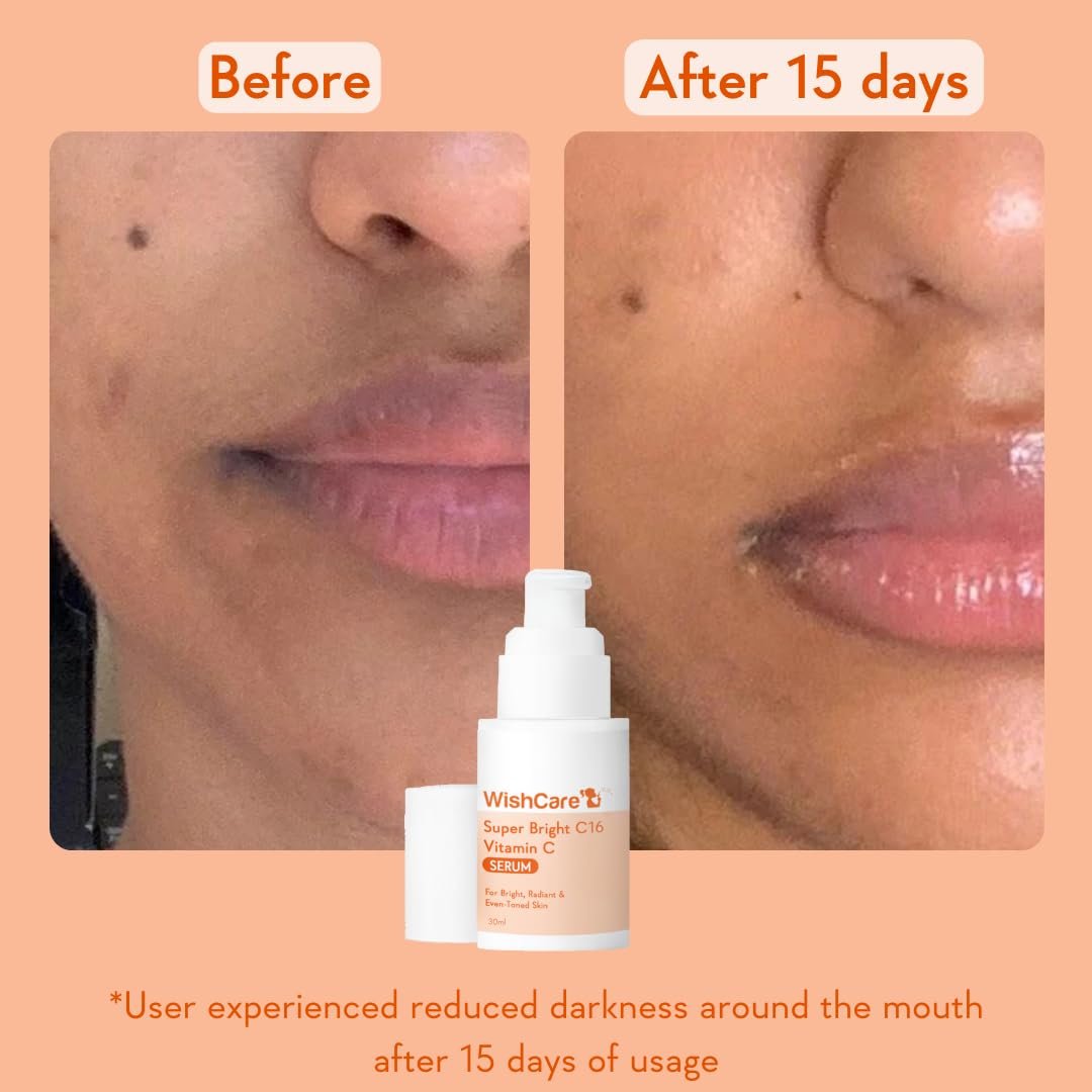 WishCare Super Bright C16 10% Vitamin C Serum For Glowing Skin | With 10% Vitamin C, Niacinamide & Kojic Acid |   For Oily Skin, Dry & Combination Skin | 30ml thumbnail