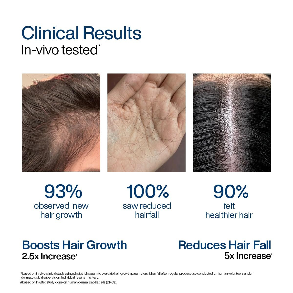 WishCare Hair Growth Serum For Scalp | 94% Saw New Hair Growth | Redensyl & Rosemary Oil | 100% Saw Hairfall Reduction | In-Vivo Tested | For Men & Women | 30ml thumbnail