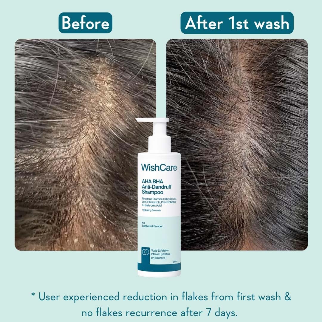 WishCare Hydrating Anti Dandruff Shampoo | 100% Dandruff Reduction | Removes Flakes & Hydrates Scalp | Proven Clinically |  For Women And Men | 250ml thumbnail