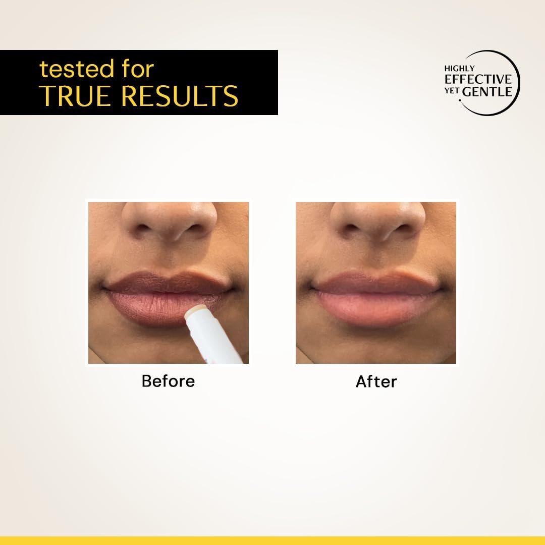 Deconstruct Brightening Lip Balm for Dark Lips | SPF 50 | Vitamin C & Resorcinol | Brightens Dark Lips & Evens Lip Tone | Vitamin E & Murumuru Butter | For Men & Women 4.2g thumbnail