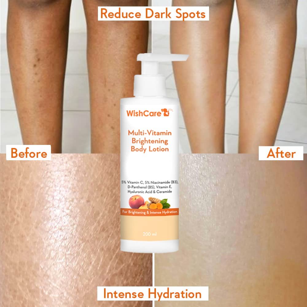 WishCare Multi-Vitamin Brightening Body Lotion - 5% Vitamin C, 5% Niacinamide(B3), Panthenol(B5), Vitamin E, Turmeric & Kakadu Plum - For Men & Women - 200 Ml thumbnail