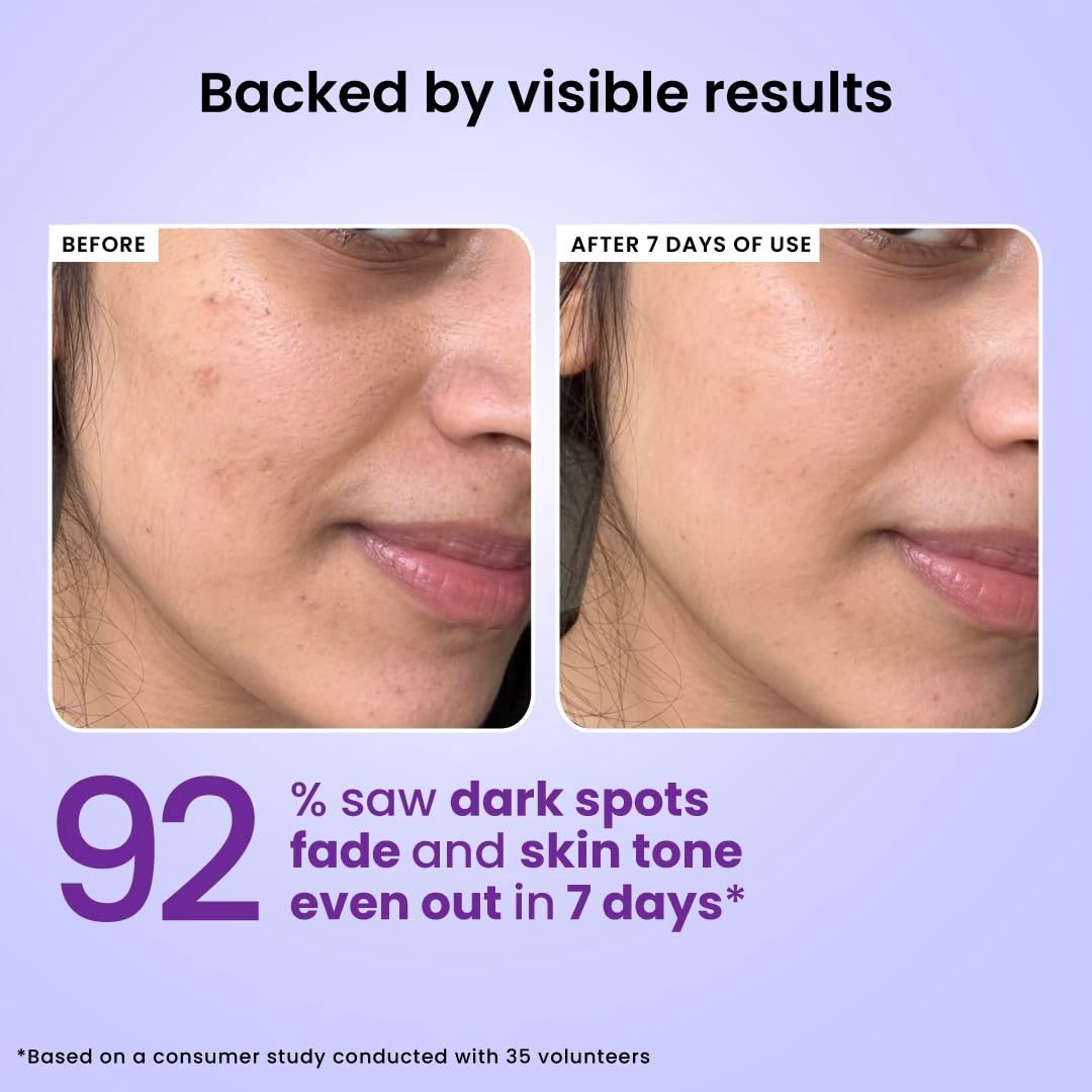 Foxtale 7% Niacinamide Face Serum | Fades Blemishes & Acne Marks | Reduce Dark Spots | Controls Oil and Brightens Skin | Lightweight & Non-sticky | All Skin Types | Men & Women - 30ml thumbnail