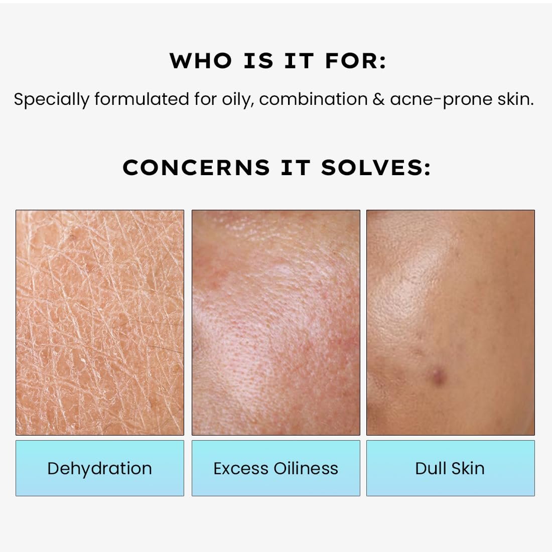 Hyphen 2% Cica Exosomes Oil-Free Moisturizer | 10X Deeper Hydration | Lightweight Water Gel with 5% Niacinamide | Controls Oil, Non-Comedogenic | Acne-Prone, Dry & Oily Skin - 50ml thumbnail