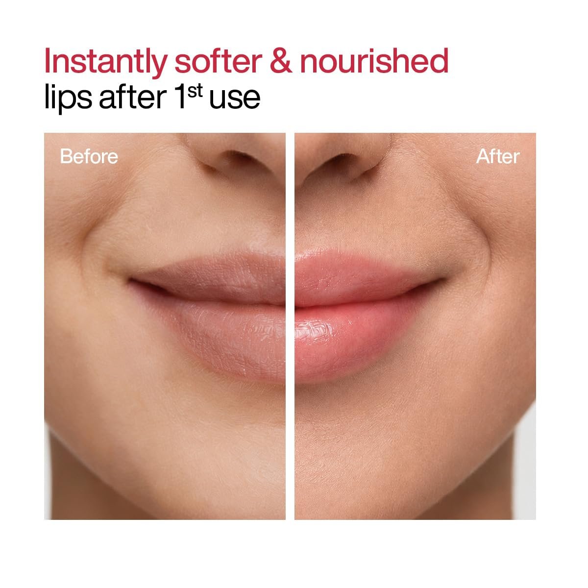 WishCare Tinted Lip Balm SPF 50 PA++++ | Brightening Lip Balm for Dark Lips | In-Vivo Tested | Kojic Acid & Niacinamide | For Women | 5g thumbnail