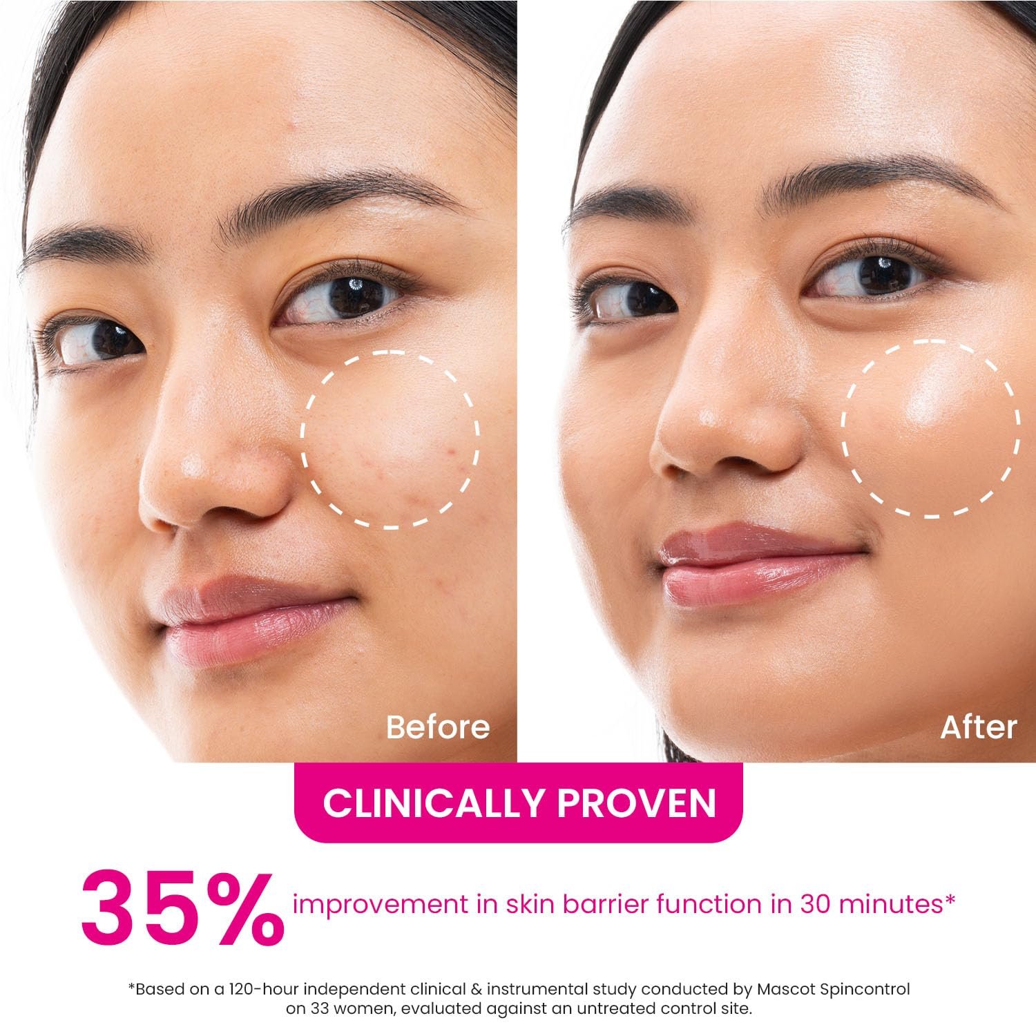 Dot & Key Dragon Fruit Bounce Jelly Moisturizer, Plant PDRN & Niacinamide, For Oily & Combination Skin, Deeply Hydrates, Bouncy, Plump Skin, Lightweight, Non-Sticky | 60ml thumbnail