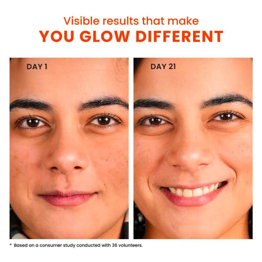 Foxtale 10% Vitamin C-Glutathione Brightening Face Serum for Glowing Skin, Treats Dark Spots, Pigmentation & Dullness, Beginner & Sensitive Skin Friendly | All Skin Types | 30ml thumbnail