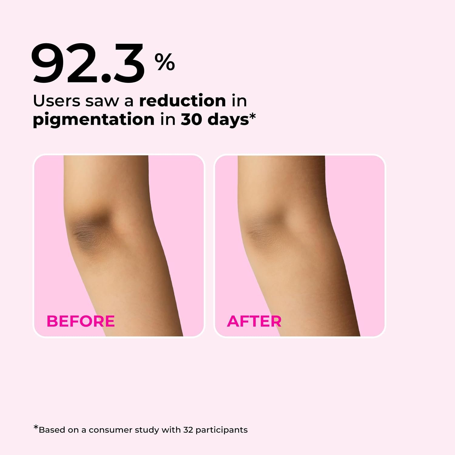 Hula Hoop Brightening Body Lotion by Foxtale| Niacinamide + Kojic Acid + SPF30 | Moisturizes, Brightens, & Even Tones Skin | Prevents Tanning & Sun Damage | Light & Grease-Free | 200ml thumbnail