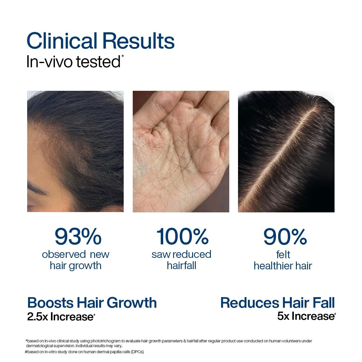 WishCare Hair Growth Serum Roll On For Scalp | 94% Saw New Hair Growth | Redensyl & Rosemary Oil | 100% Saw Hairfall Reduction | In-Vivo Tested | For Men & Women | 30ml thumbnail
