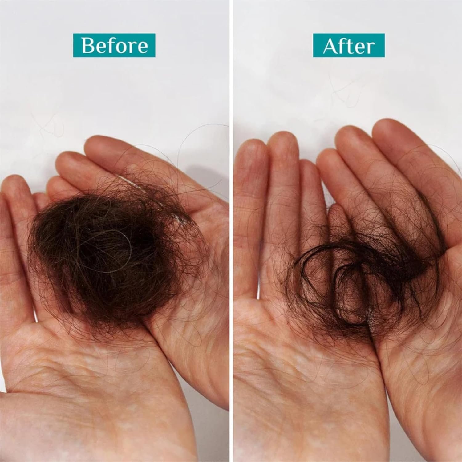 Pilgrim Redensyl & Anagain Hairfall Control Shampoo with Korean Black Rice 200ml | Anti Hairfall shampoo for Men & Women | Reduces Hairfall | Promotes Hair Thickness | For All Hair Types thumbnail