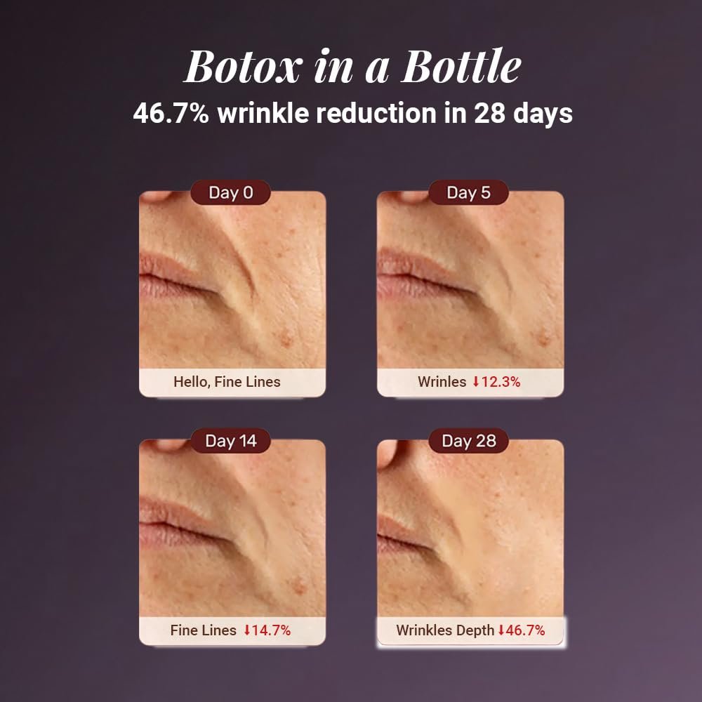 Rewind Age Reversing Gel Creme with 7.25% Advanced Peptide Complex for Wrinkle Reduction Fine Lines Smoother Firmer Skin with Vitamin C and Mandelic Acid Lightweight Anti Ageing Moisturizer thumbnail