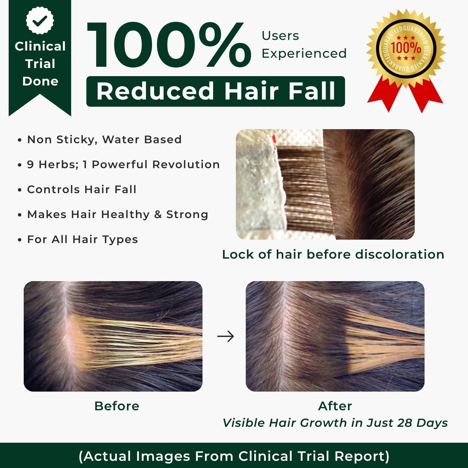 Aroma Treasures Hair Growth Serum For Scalp (Spray), Hibiscus & Bhringraj Scalp Rasa, Controls HairFall & Boosts New Hair Growth, In-Vivo Tested, For Men & Women | 60ml thumbnail