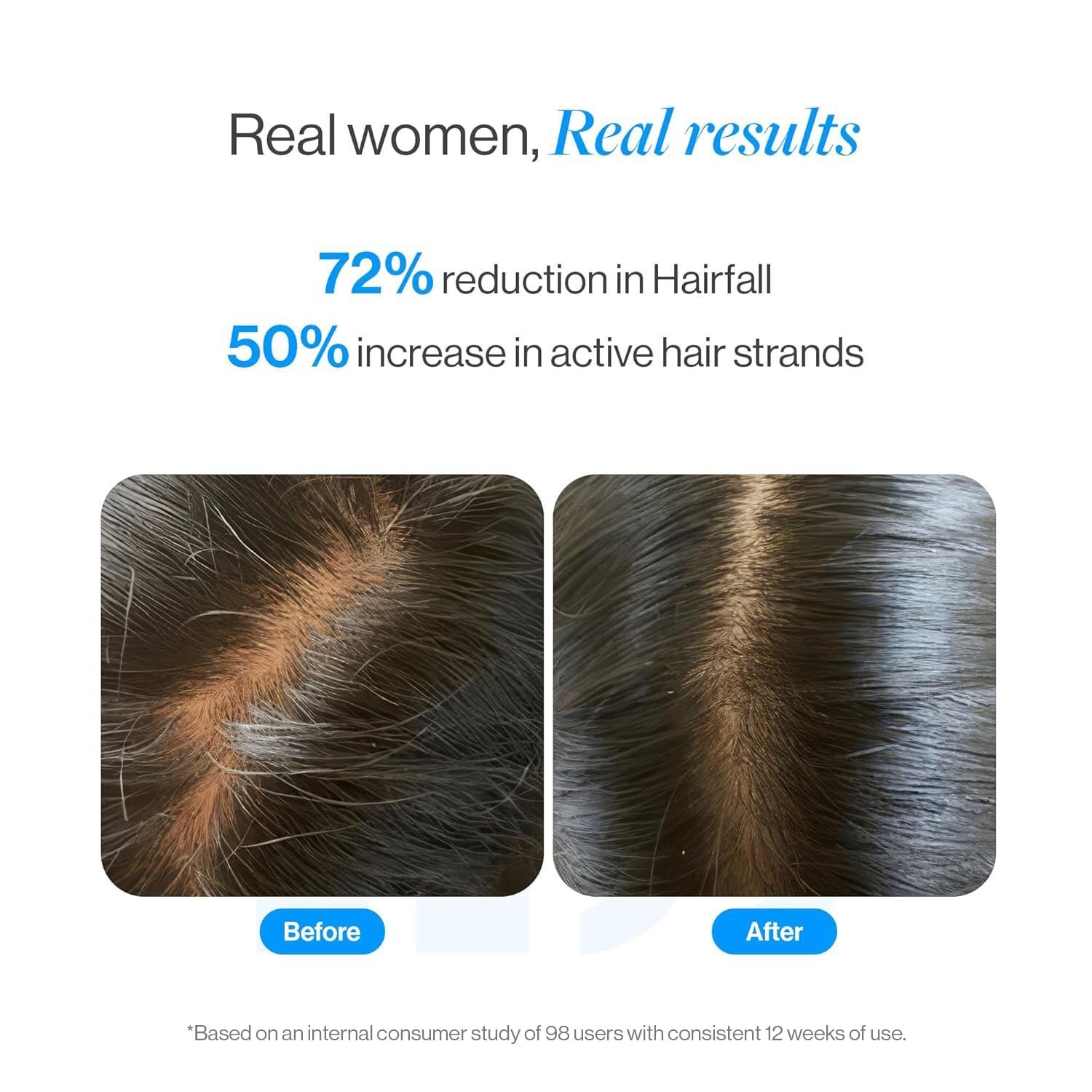 Be Bodywise Rosemary Hair Growth Serum (Roll On) | 3% Redensyl & 2% Anagain | Hair fall control serum for Women & Men | Promotes Hair Growth & Stimulates Hair Follicles | 25ml thumbnail