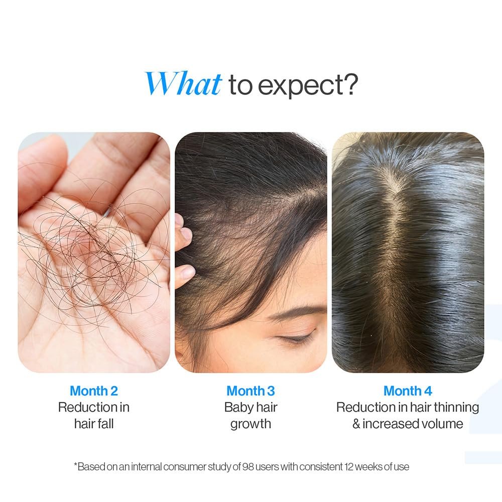 Be Bodywise Rosemary Hair Growth Serum (Roll On) | 3% Redensyl & 2% Anagain | Hair fall control serum for Women & Men | Promotes Hair Growth & Stimulates Hair Follicles | 25ml thumbnail