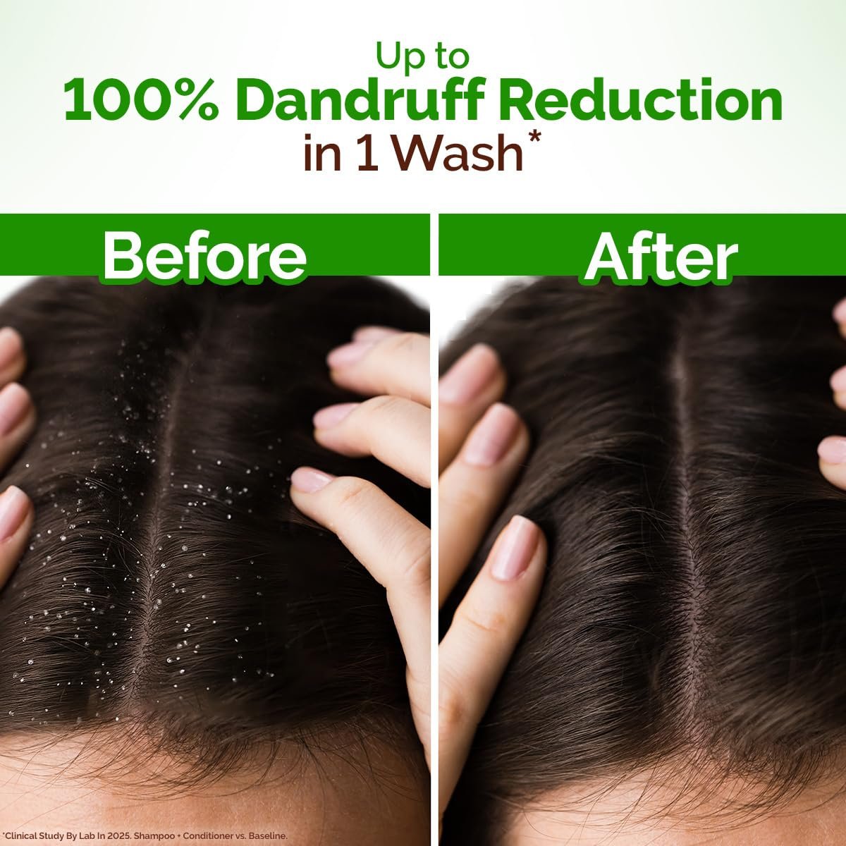 Mamaearth Lemon Anti-Dandruff Shampoo 600ml thumbnail