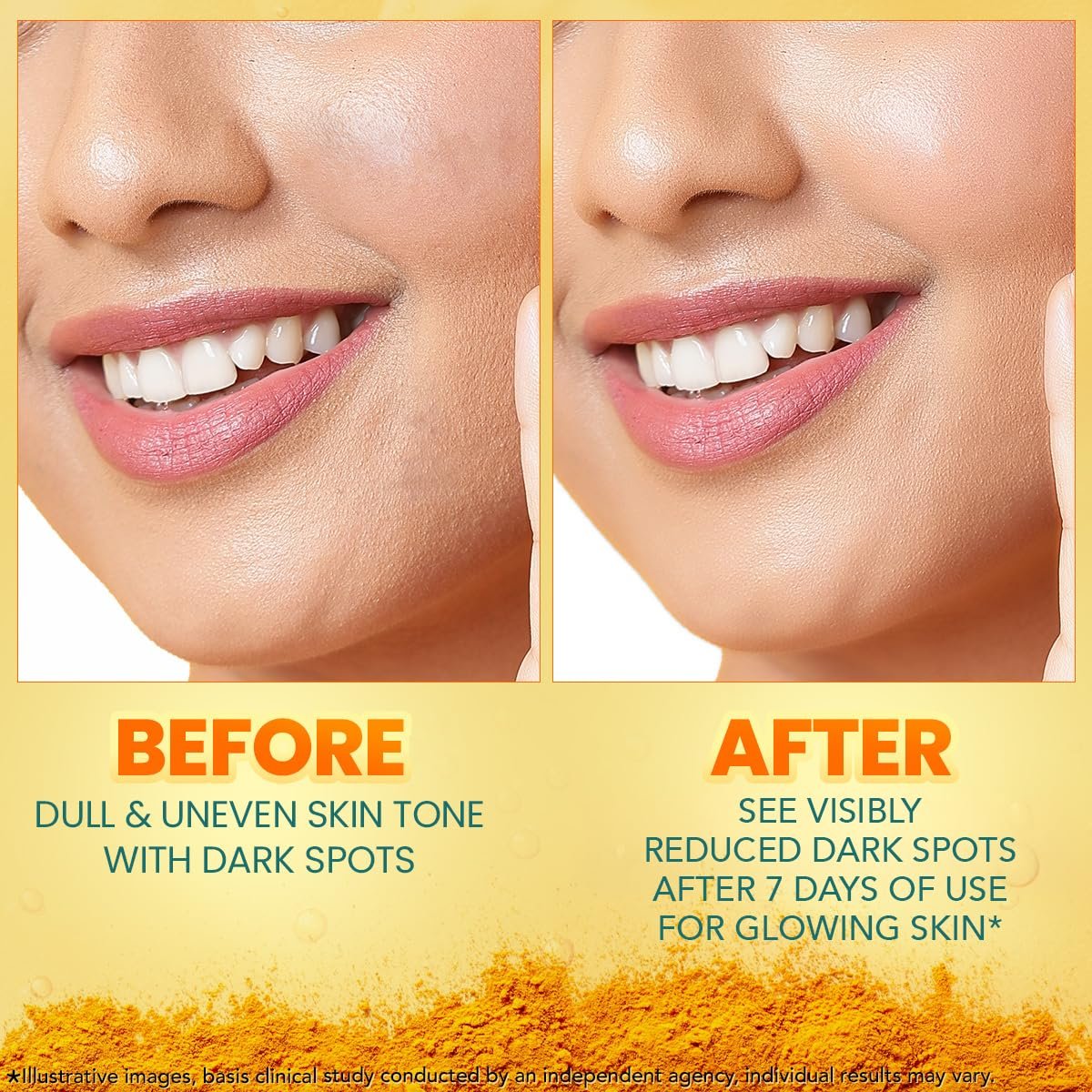 Himalaya Dark Spot Clearing Turmeric Face Serum, 15 mL Visibly Reduces Dark Spots from Day 7 | thumbnail