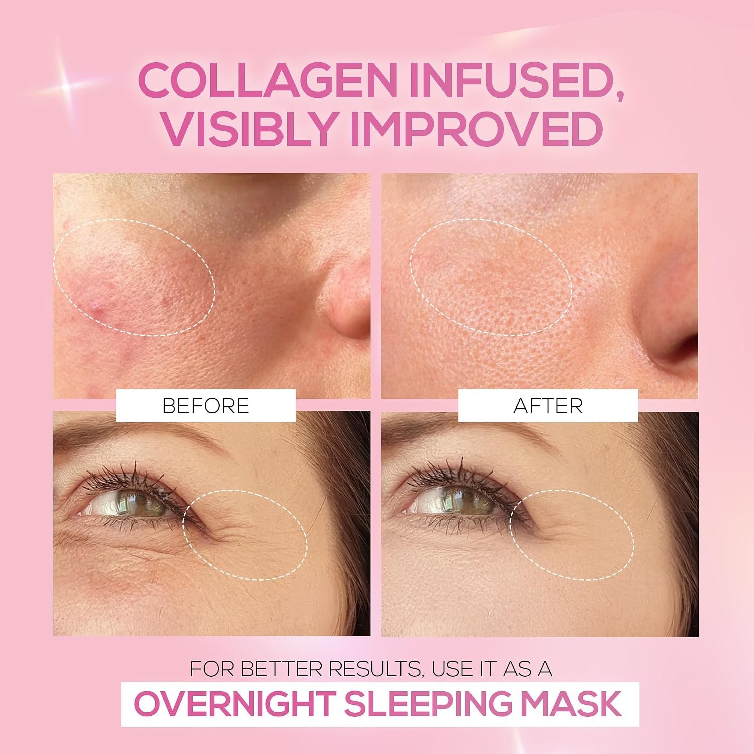 RENEE Pink Therapy Hydrolyzed Collagen Overnight Sleep Jelly Mask, 15 gm Hydrates, Repairs, Smoothens & Plumps Skin, Peptides, Niacinamide, Hydrolyzed Collagen Enriched thumbnail