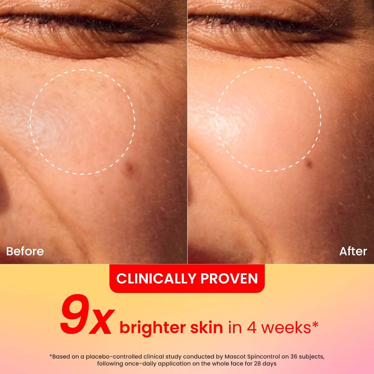 Dot & Key Vitamin C + E Super Bright Gel Moisturizer For Face, Visibly Boosts Glow, For All Skin Types 25ml thumbnail