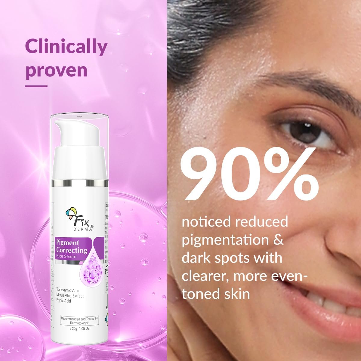 Fixderma Tranexamic Acid Pigment Correcting Serum | Face Serum for Melasma, Hyperpigmentation & Acne Spots | Acne Face Serum for Men & Women-30gm thumbnail