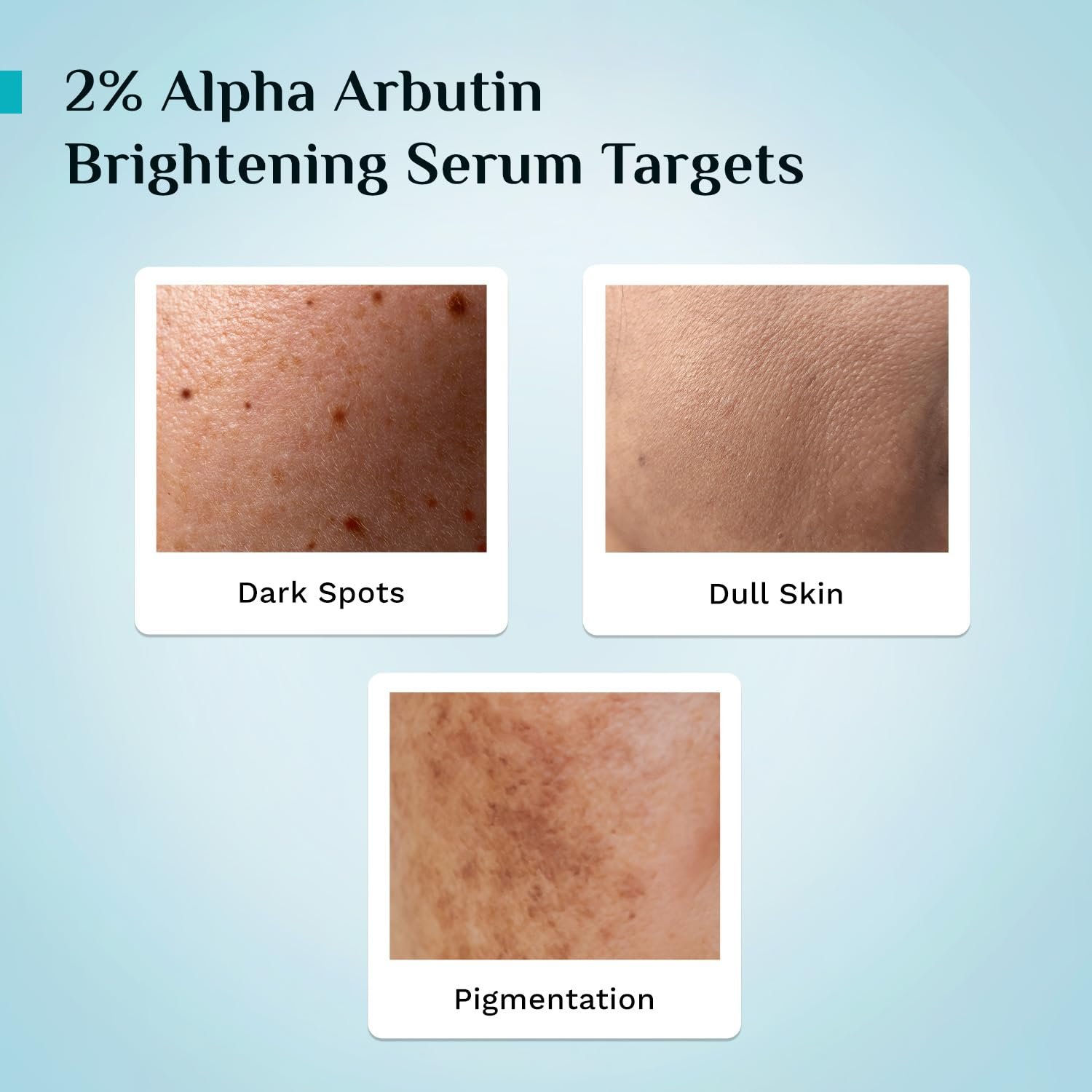 PILGRIM Korean 2% Alpha Arbutin & 3% Vitamin C Brightening Face Serum for glowing skin| Alpha arbutin face serum|All skin types | Men & Women| Korean Skin Care| Vegan & Cruelty-free | 30ml thumbnail