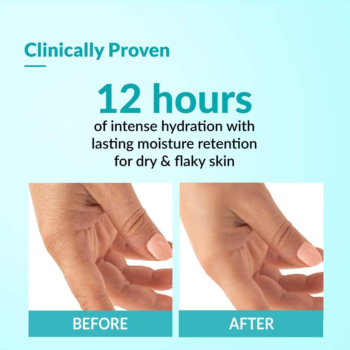 Fixderma Moisturizing cream, Daily Moisturizer for Dry & chapped skin, Provides Hydration and Moisturization, Non-Comedogenic & Non-Greasy formulation, 60g thumbnail