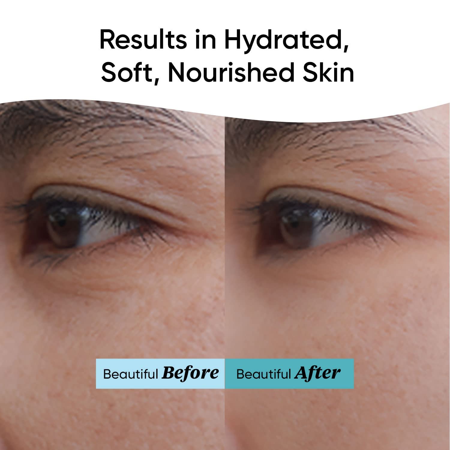 Dot & Key 72HR HYDRATING GEL + Probiotics Moisturizer for Face | With Hyaluronic Acid, Kombucha & Rice Water | Lightweight gel Moisturizer 15ml thumbnail