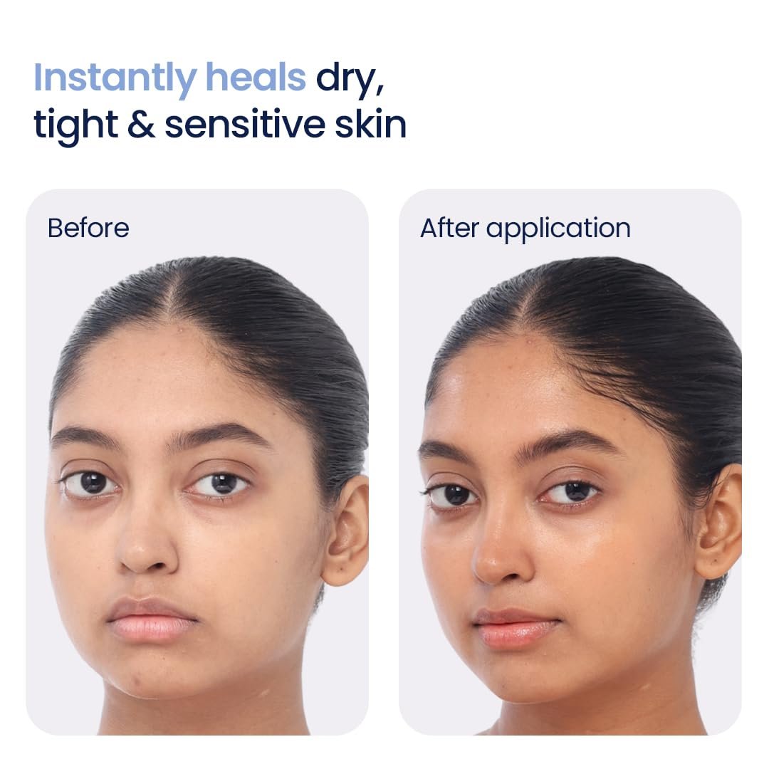 WishCare 3:1:1 Barrier Repair Moisturizer Cream for Face | Barrier Repair Moisturizer With Ceramides, EGF & Mung Mucin |  For Dry Skin, Oily & Combination Skin | thumbnail