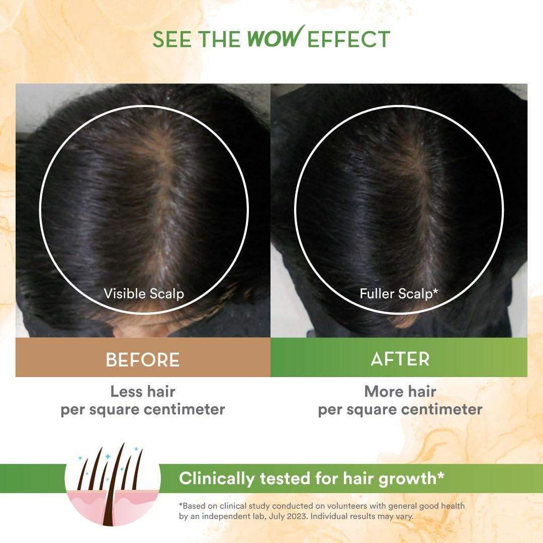 WOW Skin Science Rosemary & Biotin Hair Growth Shampoo | Fights Hair Fall | Grows New Hair | Prevents Breakage & Split Ends | Adds Shine to Dull Hair | 250ml thumbnail