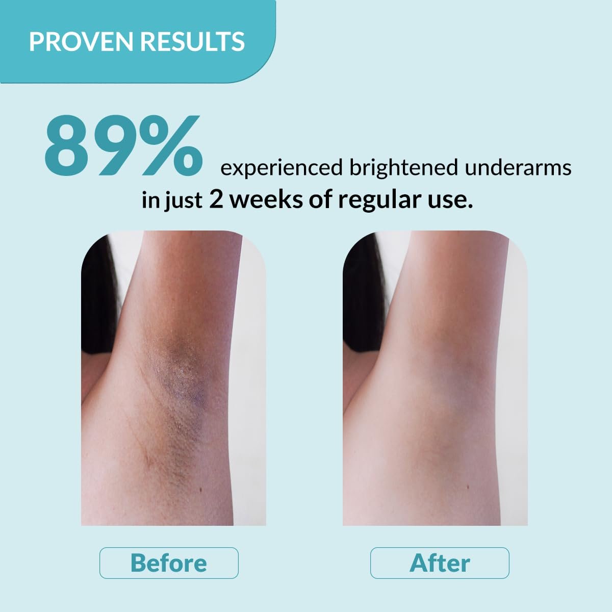 Fixderma Nigrifix Underarm Roll on with 6% AHA, Lactic Acid & 1% Mandelic Acid & Kojic Acid | Brightens Skin & Exfoliates Underarm | For All Skin Type, Men & Women - 60ml thumbnail