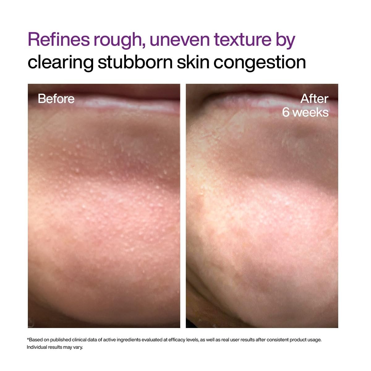 WishCare Cellular Reset 0.1% Retinal Shot- Targets Fine Lines, Wrinkles & Dark Circles | Retinol Shot Booster- 10 ml thumbnail