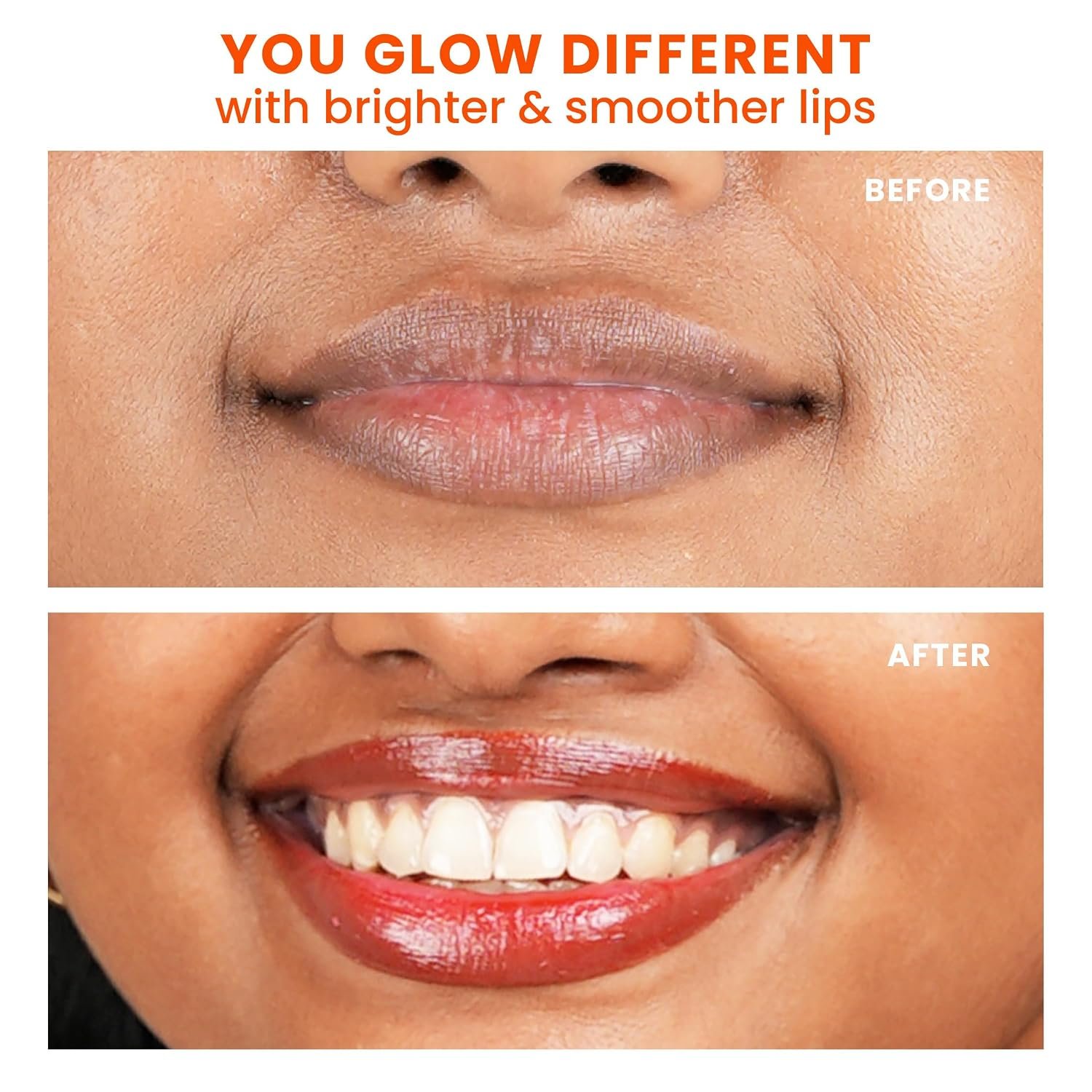 Foxtale SPF 30 Brightening Lip Balm for Dark Lips with Peptides & Vitamin C | Brightens Pigmented Lips | Hydrates Lip | SPF Lip Balm - Ruby Glaze 12gm thumbnail